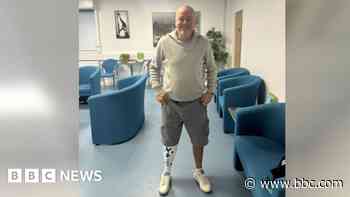 Concrete company fined after man's leg crushed