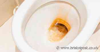 Woman's natural hack removes toilet limescale stains better than bleach