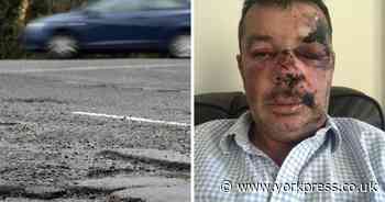 Many York roads dangerous for cyclists says man after pothole crash