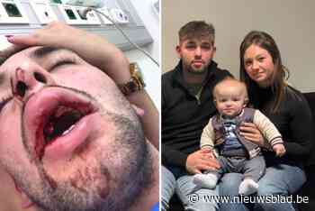Zinloze slag kost Davy (28) twee tanden, maar schadevergoeding blijft uit: vrienden starten crowdfunding voor z’n gezin