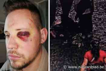 Ambulancier Dennis (33) werd op straat in elkaar geslagen en zoekt nu de vrouw die hem als eerste hielp: “Ze heeft me erdoor geholpen”