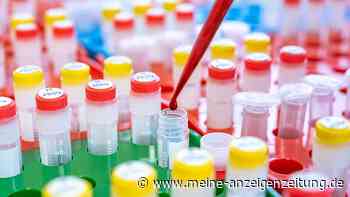 Brustkrebs bei Männern: Risiko für eine Gruppe besonders hoch – „Zahlen erst die Spitze des Eisbergs“