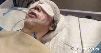 Alberta teen’s skull fractured in alleged assault at resort in Dominican Republic