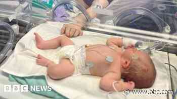My baby had seizures after 'petrifying' maternity experience