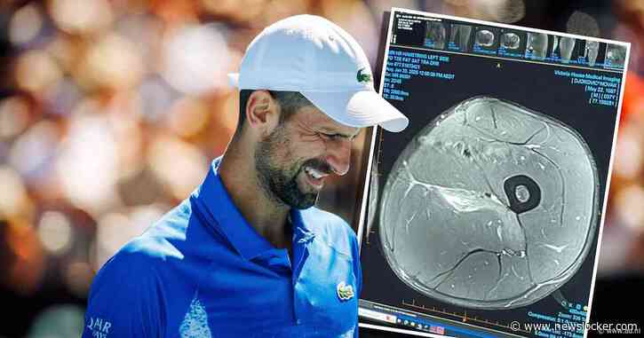 Uitgejouwde Novak Djokovic is twijfels van ‘blessure-experts’ zat en post mri-scan