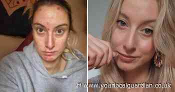 London woman reveals how 2 vodka bottles a day ruined her relationships