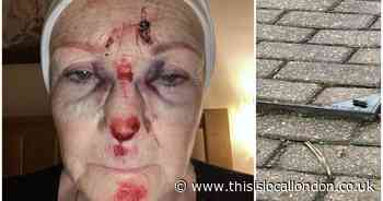 Woman's face left smashed up after tripping over raised manhole in West Wickham