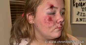 Mum's horror as schoolgirl left 'black and blue' in hit-and-run as driver leaves her at side of road