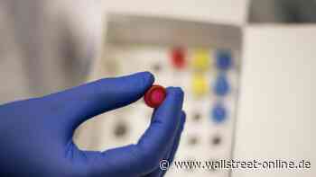 Klasse Zahlen: AbbVie Aktie knallt nach oben – Rheumamittel läuft wie geschmiert