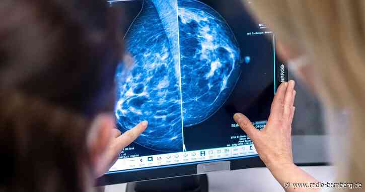 Studie: Brustkrebs bei Männern seltener, aber tödlicher
