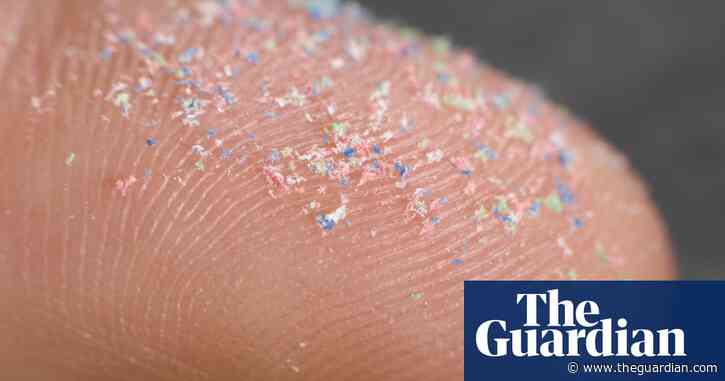 Levels of microplastics in human brains may be rapidly rising, study suggests