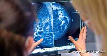 Studie: Brustkrebs bei Männern seltener, aber tödlicher