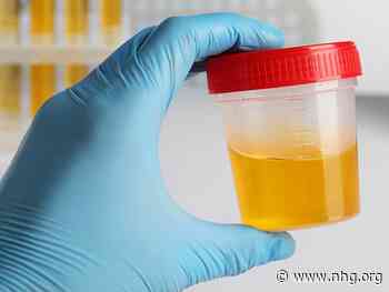 Nieuw: hematurie in LESA Laboratoriumdiagnostiek