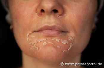 Evertz Pharma warnt: Kosmetik kann die Haut ruinieren!