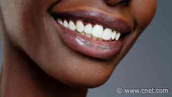 Best Whitening Toothpaste of 2025, According to Dentists