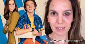 Disney-actrice in gezicht geschoten tijdens verjaardagsfeest: ‘Zo dankbaar dat ik nog leef’