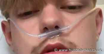 'I started coughing up blood and doctors said it was down to vaping'