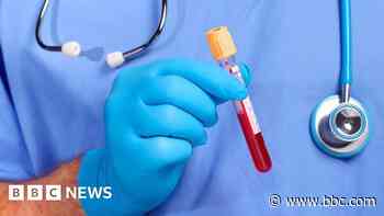 Dozens of HIV and hepatitis diagnoses in A&E tests