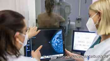 Frau forscht an Brustkrebs, dann erkrankt sie selbst – bestimmte Hautveränderung machte sie stutzig