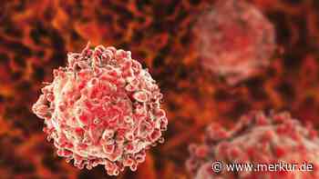 Schleichende Gefahr: Die unsichtbaren Anzeichen chronischer Leukämie