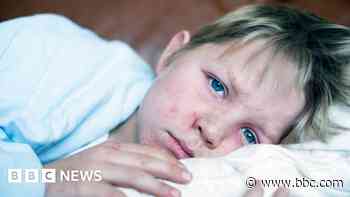 Parents warned as measles cases rise