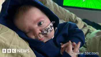 Thousands raised for 'perfect' baby born with rare condition