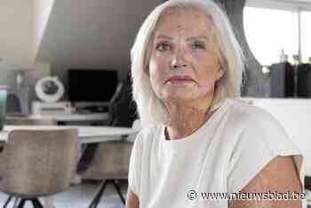 Exact tien jaar geleden werd Marina slachtoffer van zuuraanval: “Ik probeer nog steeds mijn littekens te verbergen met mijn haar”