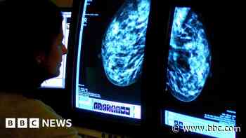 New funding for breast cancer  recurrence research