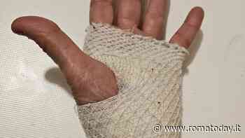 Anziana azzannata alla mano da un cane mentre passeggia in strada