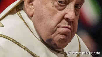 Papst-Drama: Jetzt auch noch Nieren-Alarm! Dialyse droht – Münchner Herzspezialist erklärt Komplikation