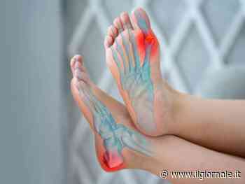 Alluce valgo: di cosa si tratta e come si cura