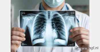 Tweede geval van besmettelijke tbc ontdekt bij Maître