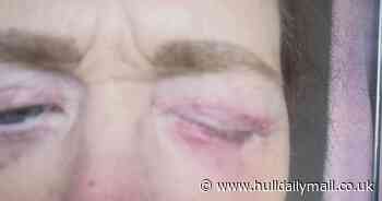 'I can't close my eyes after horror movie surgery in Turkey'