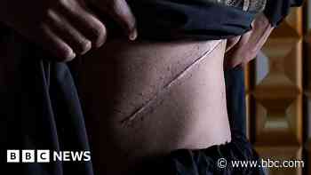 Myanmar villagers reveal 'desperate' illegal kidney sales