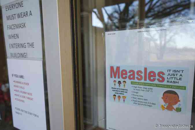 First measles death is reported in the West Texas outbreak that’s infected more than 120 people