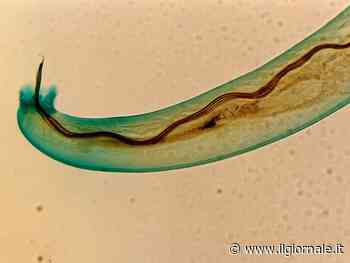 Pensava fosse mal di testa da jet lag ma aveva un parassita nel cervello. Il caso choc