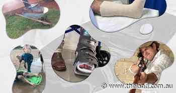 The Skimboard Saga: Life lessons learnt from a bushie with a broken ankle