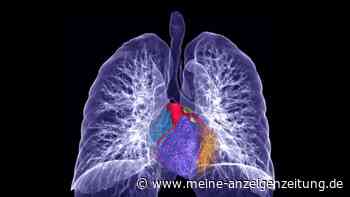 Immer mehr Nichtraucher erkranken an Lungenkrebs: Forscher finden eine Ursache