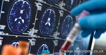 Rare dementia red flag symptoms that could be seen in the way you eat