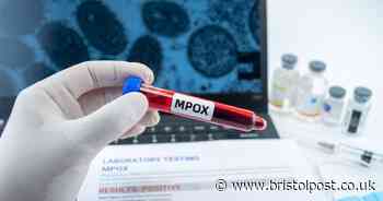 Doctors find new 'highly infectious' strain of deadly mpox virus