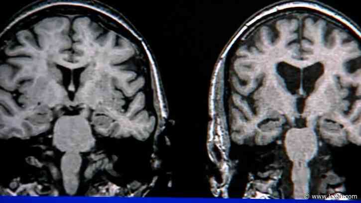 Future of dementia research up for a vote in Texas Senate