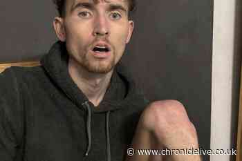 'I spent £2,000 a month on ketamine until I was a 7stone skeleton'