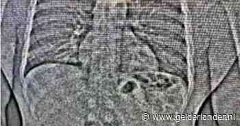 Dief jatte voor meer dan miljoen dollar aan sieraden en slikte ze in, juwelier krijgt ze pas na toiletbezoek terug