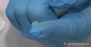 Calgary company develops NanoSALV gel to help heal chronic wounds