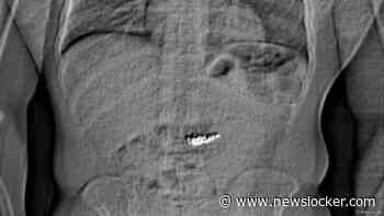 Juwelendief in VS slikt peperdure oorbellen in tijdens arrestatie