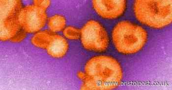 UK alert after discovery of case of Ebola-like disease that causes bleeding and can kill