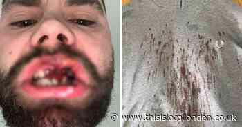 'I lost my teeth in a random Kent pub attack - now my child won't look at me'