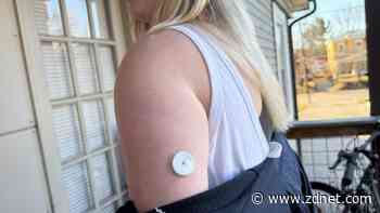 This OTC glucose monitor encouraged me to change my eating habits - here's how