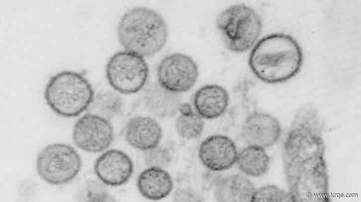 State veterinarian sheds light on hantavirus in New Mexico