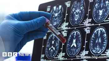 Software bug at firm left NHS data 'vulnerable to hackers'